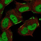 Immunofluorescent staining of human cell line SH-SY5Y shows localization to nucleoplasm & plasma membrane.