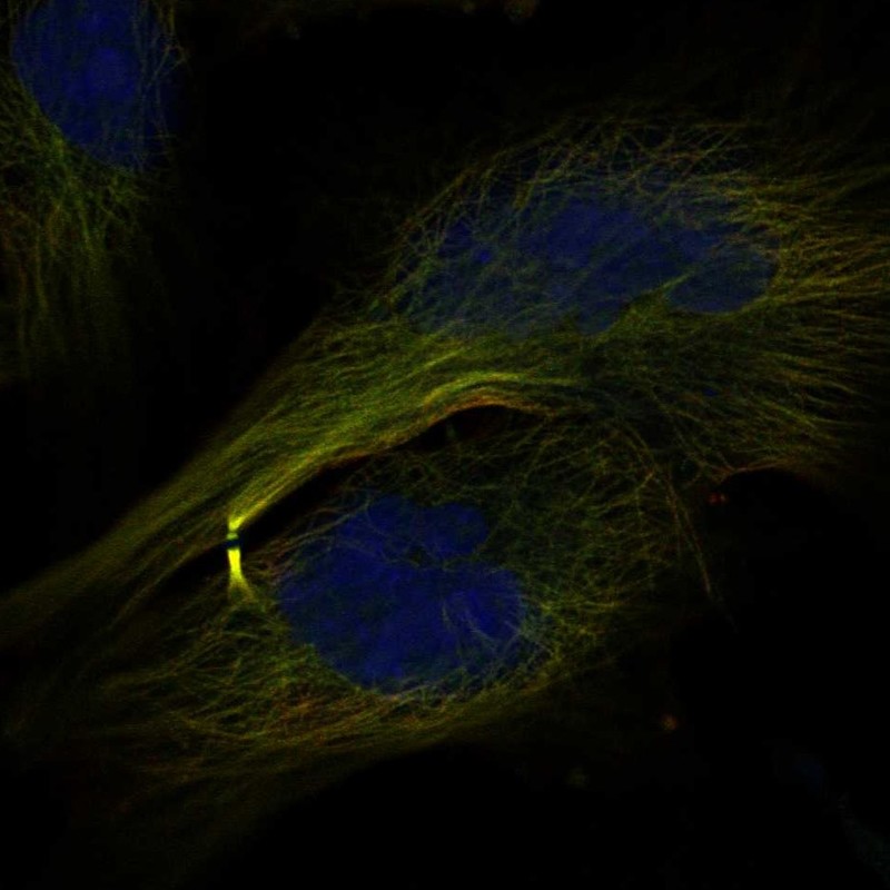 Anti-CENPE Antibody