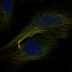 Anti-CENPE Antibody