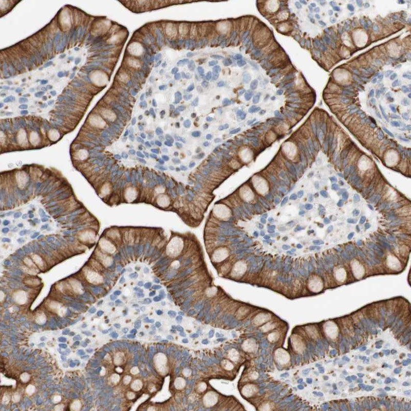 Anti-FNDC9 Antibody