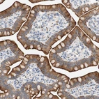 Anti-FNDC9 Antibody
