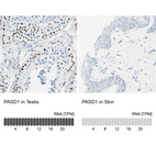 Anti-PASD1 Antibody