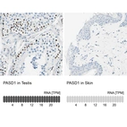 Anti-PASD1 Antibody