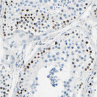 Immunohistochemical staining of human testis shows strong nuclear positivity in cells in seminiferous ducts.