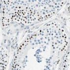 Immunohistochemical staining of human testis shows strong nuclear positivity in cells in seminiferous ducts.