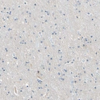 Immunohistochemical staining of human cerebral cortex shows no positivity in neurons as expected.