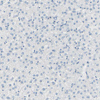 Immunohistochemical staining of human liver shows no positivity in hepatocytes as expected.