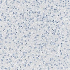Immunohistochemical staining of human liver shows no positivity in hepatocytes as expected.