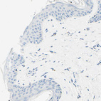 Immunohistochemical staining of human skin shows no positivity in squamous epithelial cells as expected.