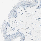 Immunohistochemical staining of human skin shows no positivity in squamous epithelial cells as expected.