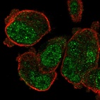 Immunofluorescent staining of human cell line PC-3 shows localization to nuclear speckles.