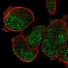 Immunofluorescent staining of human cell line PC-3 shows localization to nuclear speckles.