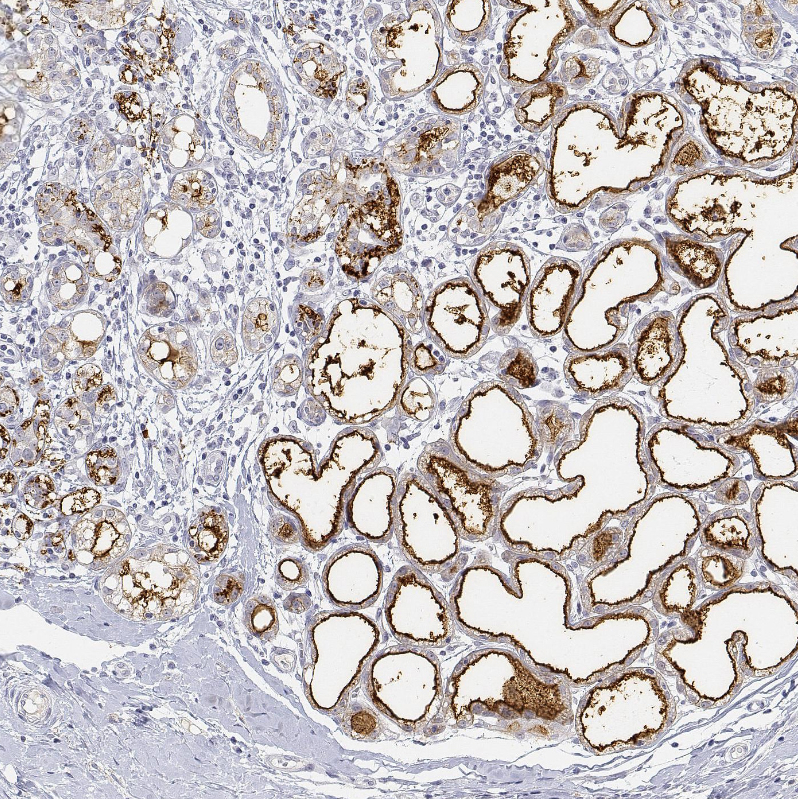Anti-BTN1A1 Antibody