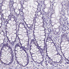 Immunohistochemical staining of human colon shows no positivity in glandular cells as expected.