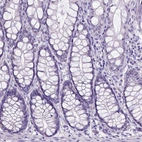 Immunohistochemical staining of human colon shows no positivity in glandular cells as expected.