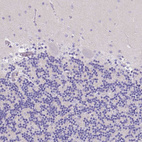 Immunohistochemical staining of human cerebellum shows no positivity in Purkinje cells as expected.