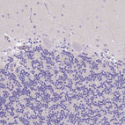 Anti-BTN1A1 Antibody