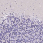 Immunohistochemical staining of human cerebellum shows no positivity in Purkinje cells as expected.
