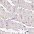 Immunohistochemical staining of human skeletal muscle shows no positivity in myocytes as expected.