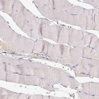 Immunohistochemical staining of human skeletal muscle shows no positivity in myocytes as expected.