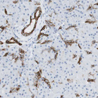 Anti-NDST4 Antibody