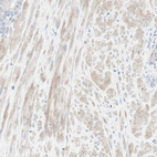 Immunohistochemical staining of human prostate shows weak cytoplasmic positivity in smooth muscle cells.