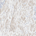 Anti-NDST4 Antibody