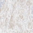 Immunohistochemical staining of human prostate shows weak cytoplasmic positivity in smooth muscle cells.