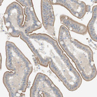 Immunohistochemical staining of human duodenum shows moderate membranous positivity in glandular cells.