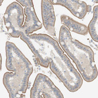 Anti-NDST4 Antibody