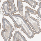 Immunohistochemical staining of human duodenum shows moderate membranous positivity in glandular cells.