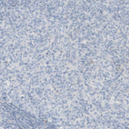 Immunohistochemical staining of human lymph node show no positivity in germinal center cells as expected.