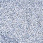 Immunohistochemical staining of human lymph node show no positivity in germinal center cells as expected.