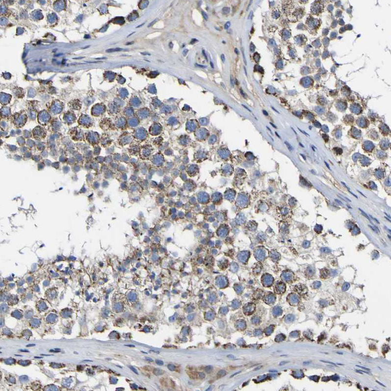 Anti-CCDC90B Antibody
