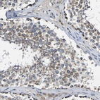 Anti-CCDC90B Antibody