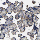 Immunohistochemical staining of human placenta shows moderate granular cytoplasmic positivity in trophoblastic cells.