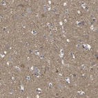 Immunohistochemical staining of human cerebral cortex shows moderate positivity in neuropil.