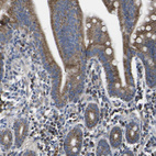 Immunohistochemical staining of human small intestine shows moderate granular cytoplasmic positivity in glandular cells.