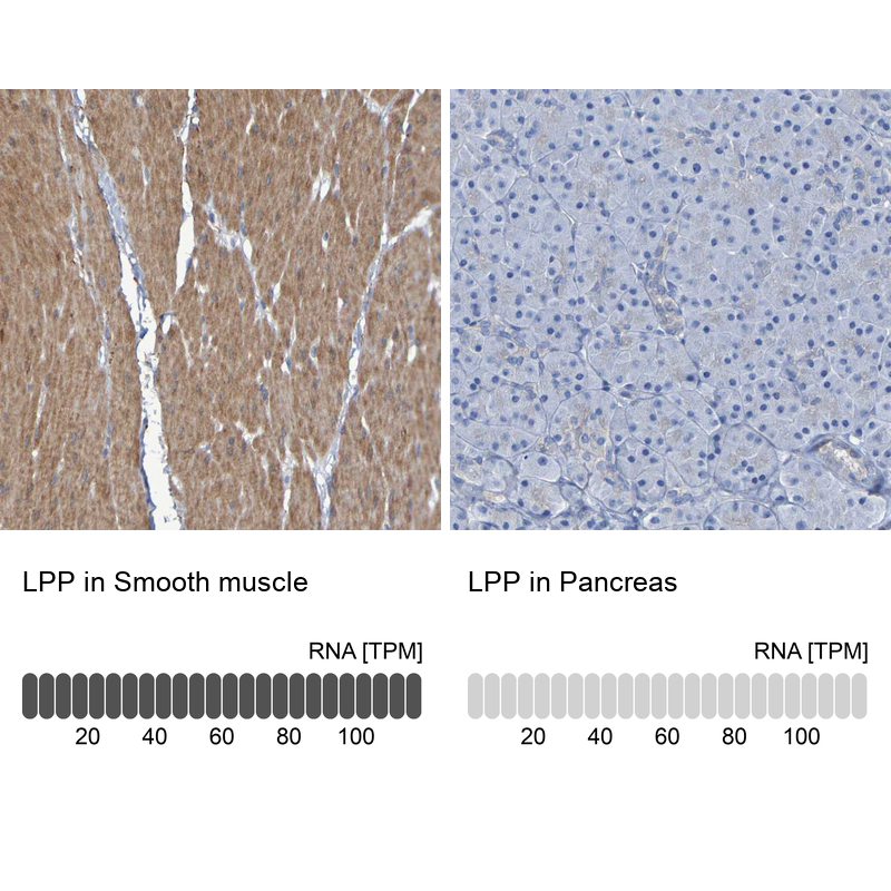 Anti-LPP Antibody