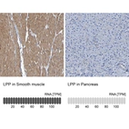 Anti-LPP Antibody