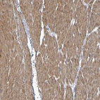 Immunohistochemical staining of human smooth muscle shows high expression.