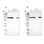 Western blot analysis using Anti-LPP antibody HPA011133 (A) shows similar pattern to independent antibody HPA017342 (B).