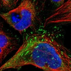 Immunofluorescent staining of human cell line U-2 OS shows localization to cytosol & focal adhesion sites.