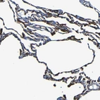 Immunohistochemical staining of human lung shows moderate membranous positivity in macrophages.