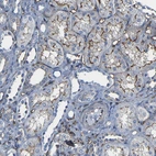 Immunohistochemical staining of human kidney shows moderate membranous positivity in cells in tubules.