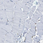 Immunohistochemical staining of human skeletal muscle shows no positivity in myocytes as expected.