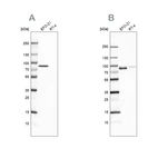 Western blot analysis using Anti-MSN antibody HPA011135 (A) shows similar pattern to independent antibody HPA011227 (B).