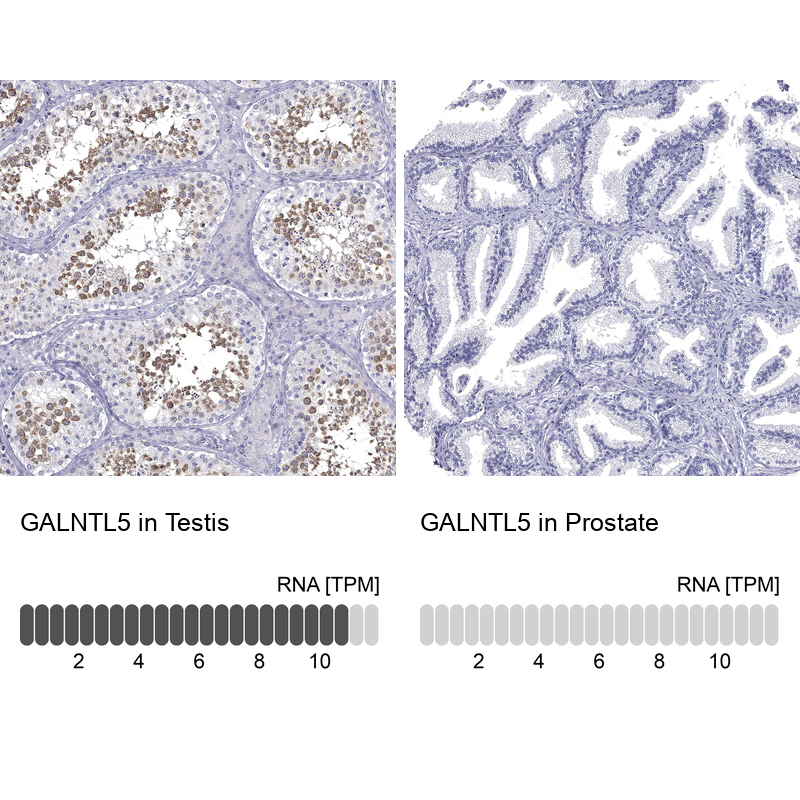 Anti-GALNTL5 Antibody