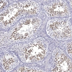 Immunohistochemical staining of human Testis shows strong granular cytoplasmic positivity in cells in seminiferous ducts.