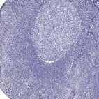 Immunohistochemical staining of human Tonsil shows no positivity in non-germinal center cells as expected.